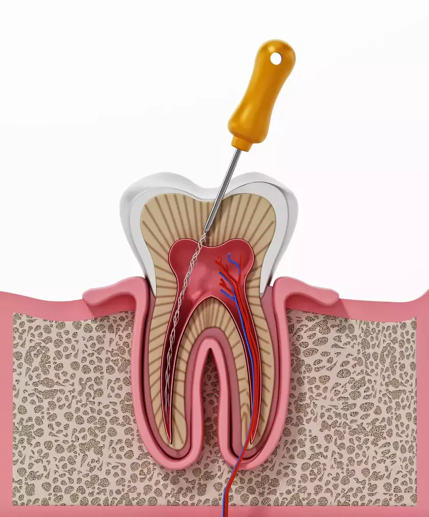 rct-process-cross-section