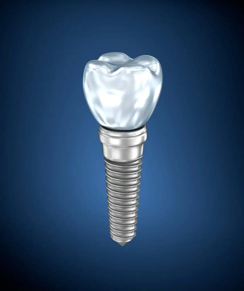 titanium-implant